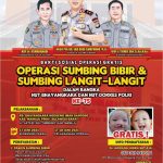 Jelang Hari Bhayangkara Ke-75, Bid Dokkes Polda Sulbar Gelar Operasi Bibir Sumbing Gratis
