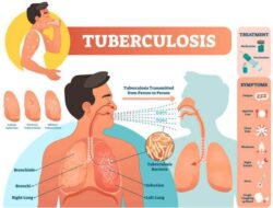 Kasus TBC di Mamasa Meningkat, Pemda Diminta Perkuat Penanganan